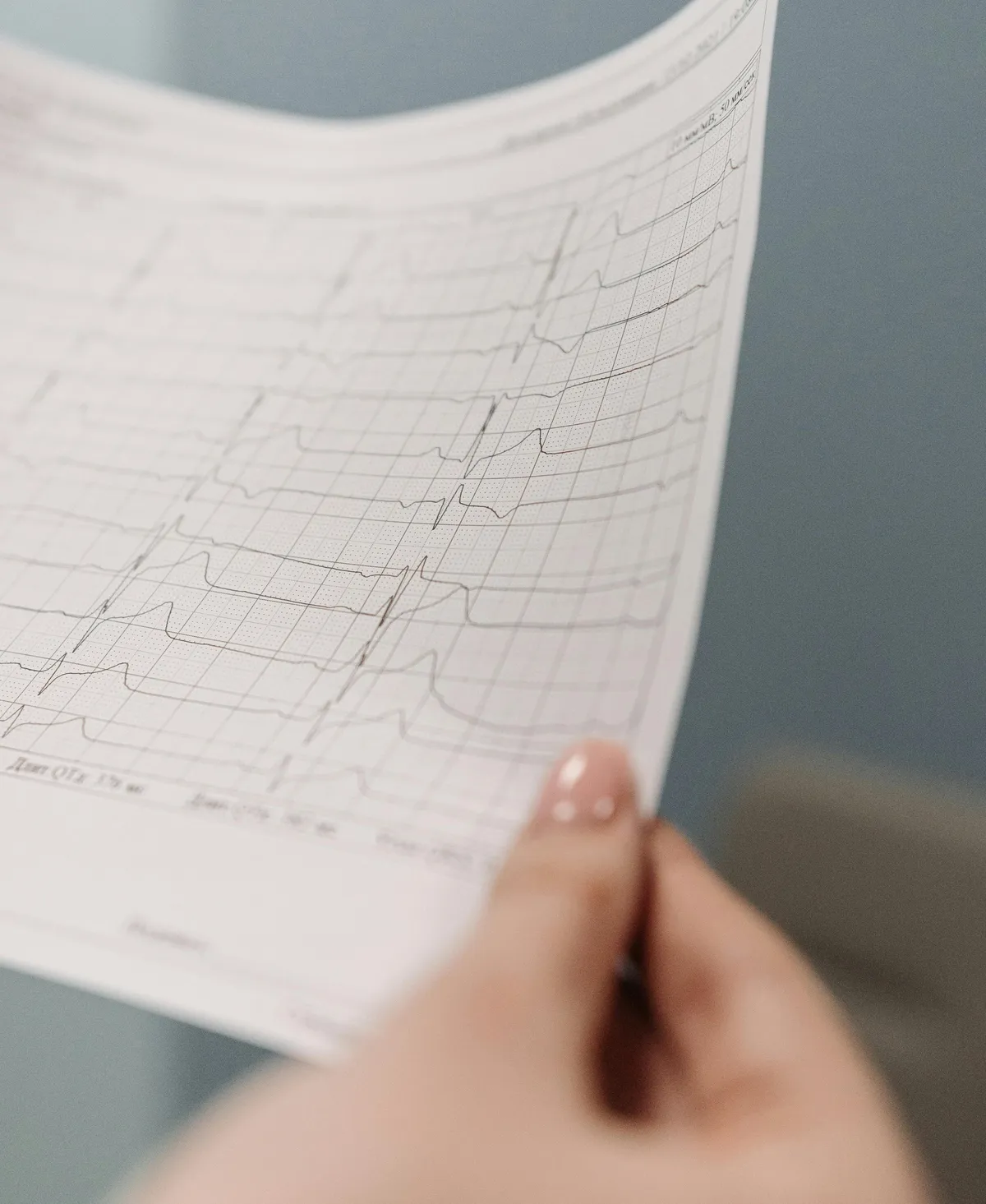 EKG printout being reviewed